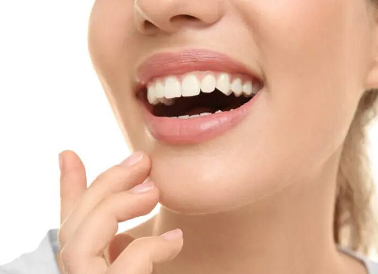 Πώς να αφαιρέσετε την πέτρα από τα δόντια σας με φυσικό τρόπο σε 4 εκδοχές!