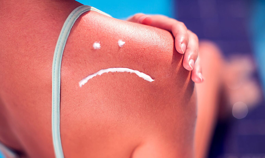 20 τρόποι με τους οποίους ένα ηλιακό έγκαυμα βλάπτει τη συνολική υγεία σας