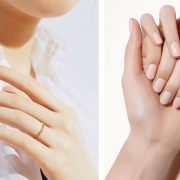 Ξεφλούδισμα του δέρματος γύρω από τα νύχια: Τι σημαίνει και πώς το αντιμετωπίζουμε;